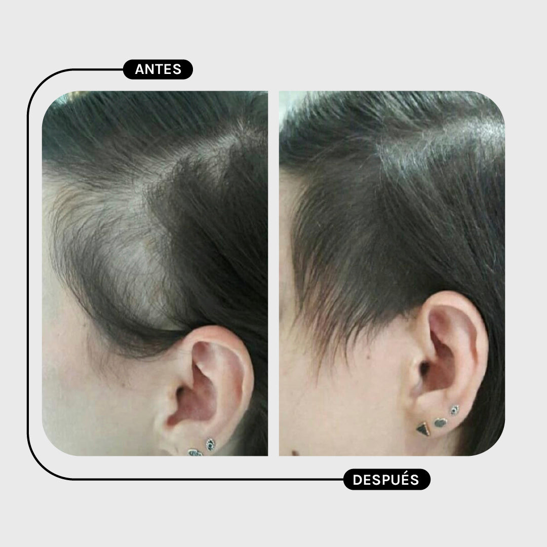 SHAMPOO AMINO +