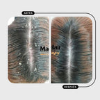 SHAMPOO CONTROL CASPA