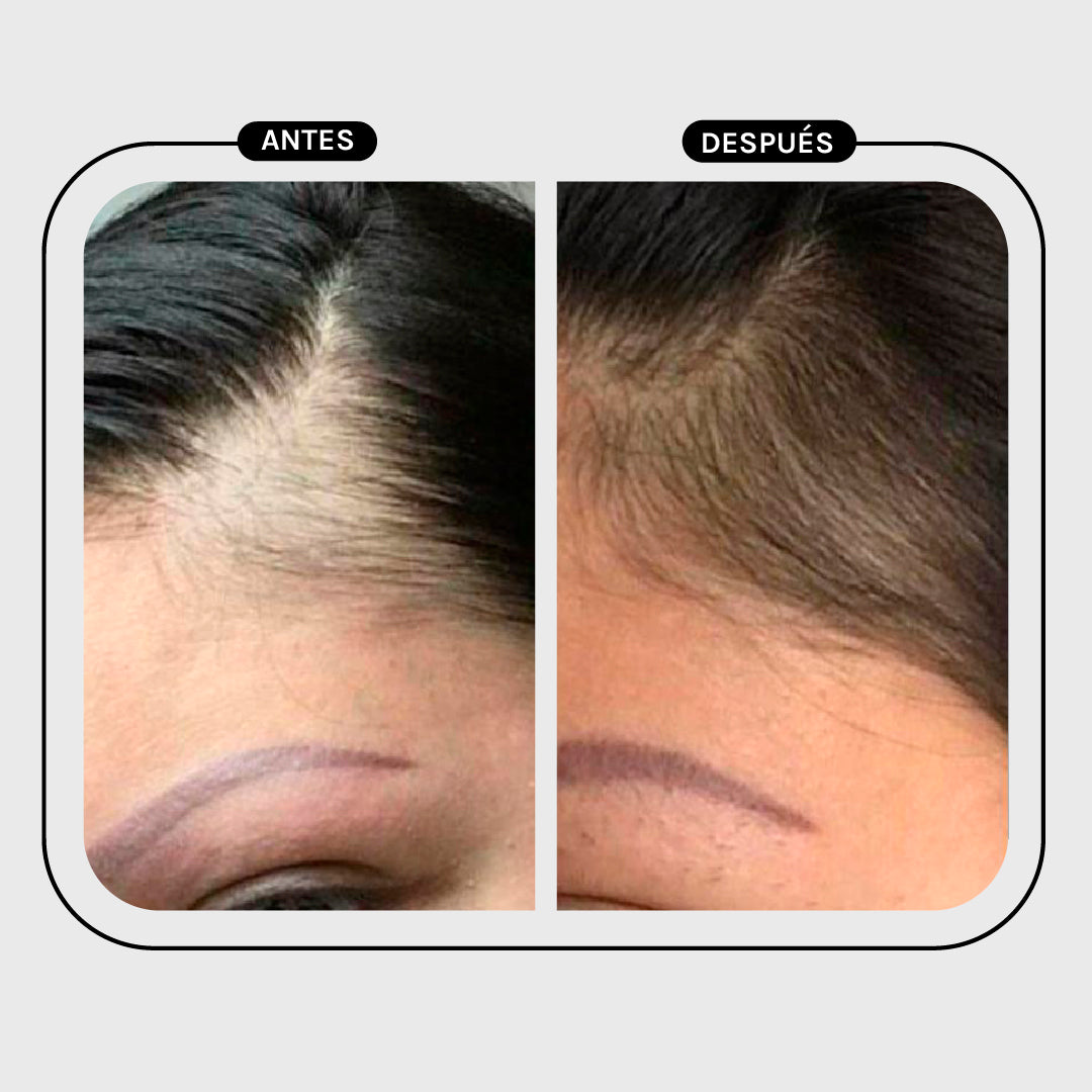 ACONDICIONADOR ANTICAÍDA SECO