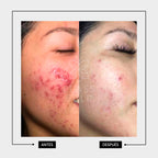 JABÓN FACIAL ANTIOXIDANTE PIEL GRASA