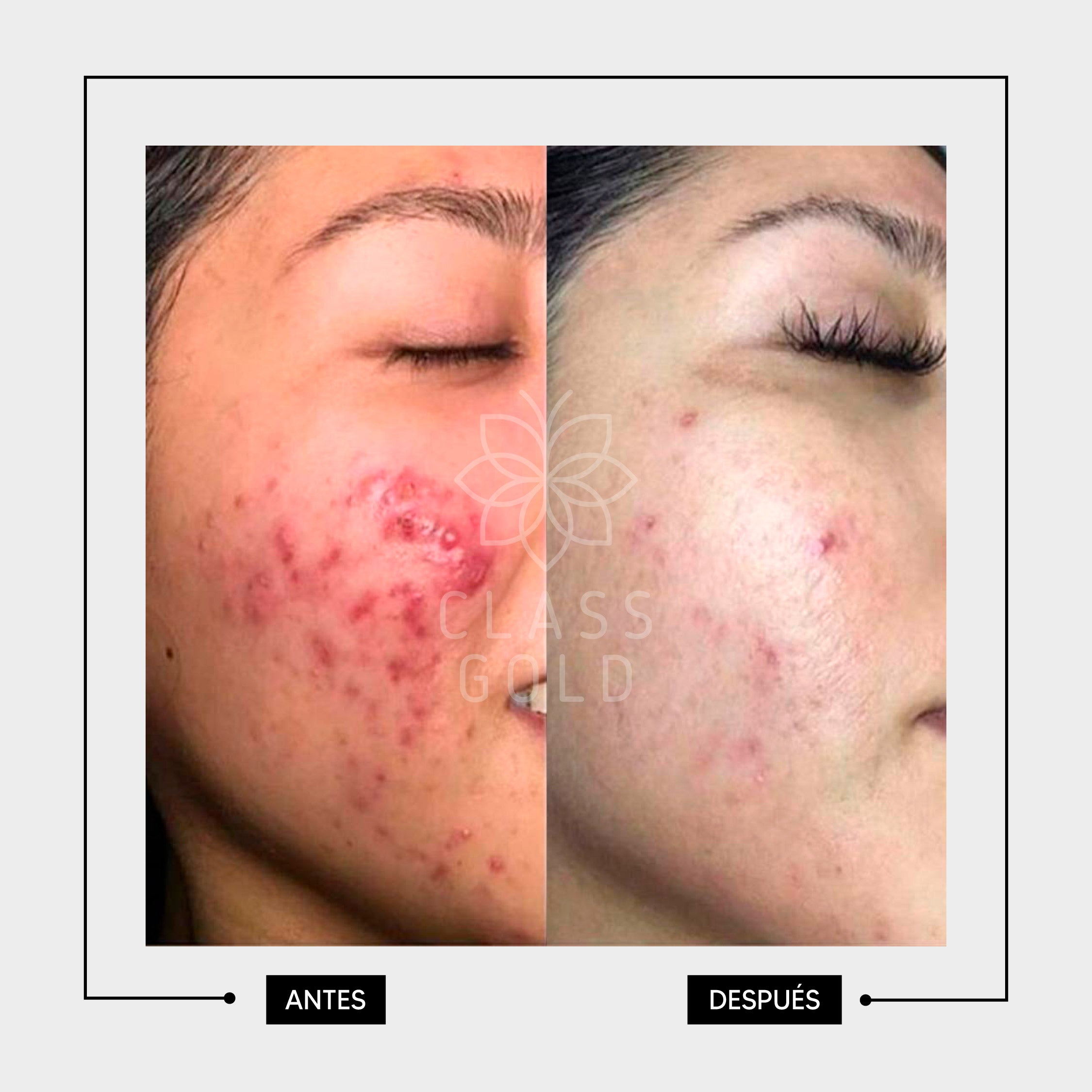 JABÓN FACIAL ANTIOXIDANTE PIEL GRASA