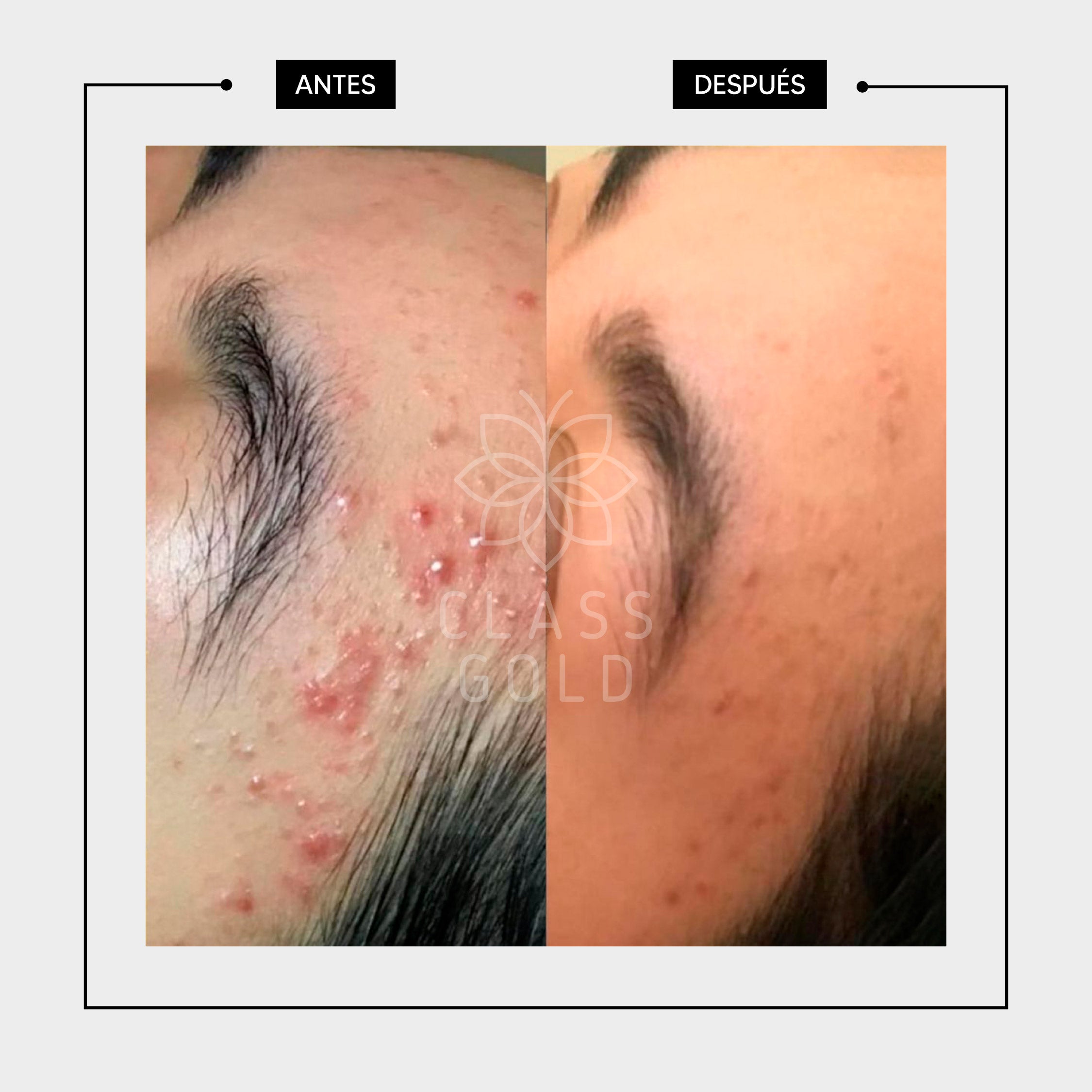 JABÓN FACIAL ANTIOXIDANTE PIEL SECA