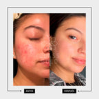 SÉRUM FACIAL + ALOEV