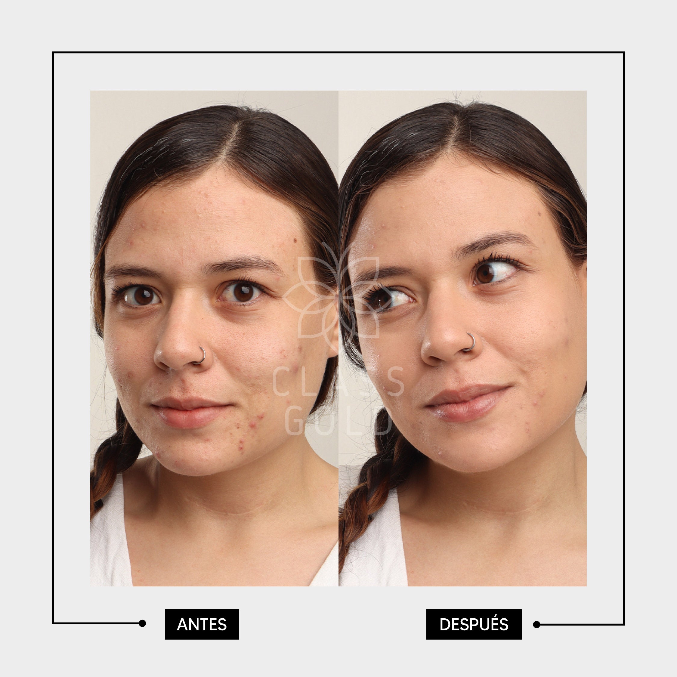 BLOQUEADOR FACIAL COLOR PIEL