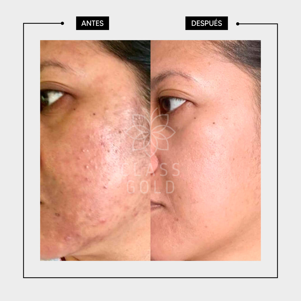 SÉRUM FACIAL
