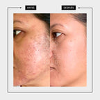 SÉRUM FACIAL