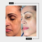 TÓNICO ACLARANTE FACIAL 25ML