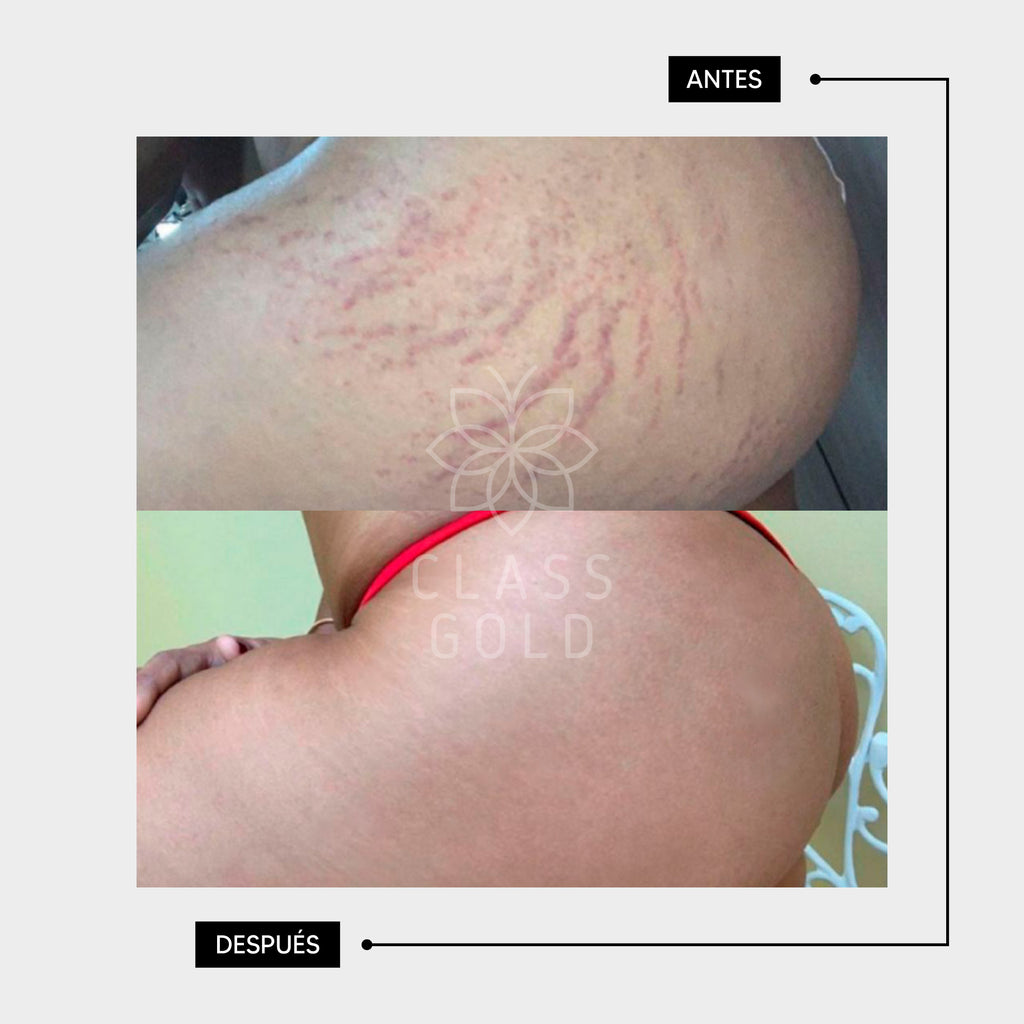 ACEITE MULTIBENEFICIOS PEQUEÑO 120ML