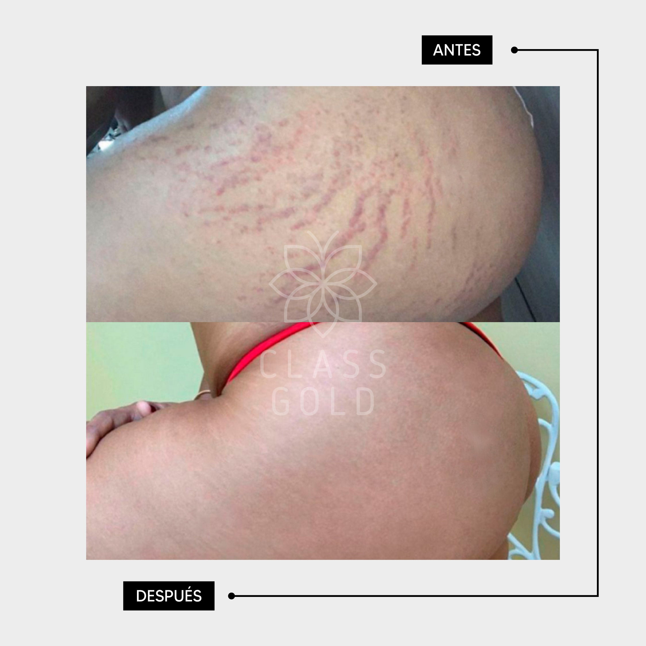 ACEITE MULTIBENEFICIOS PEQUEÑO 120ML