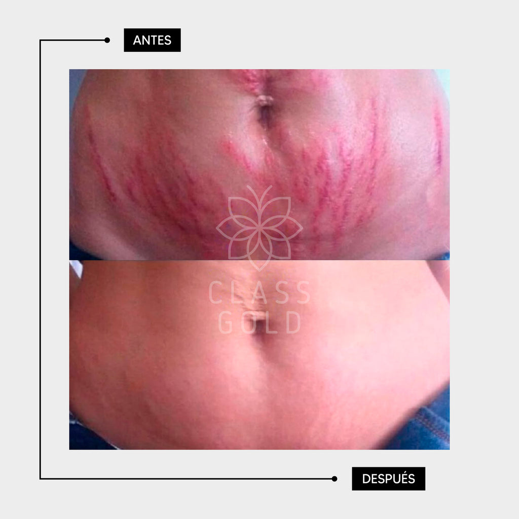 ACEITE MULTIBENEFICIOS GRANDE 300ML