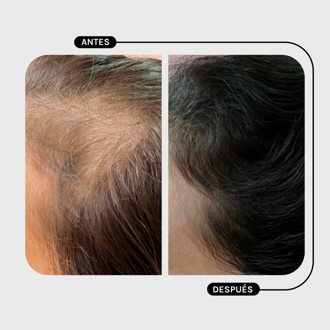 ACONDICIONADOR AMINO +