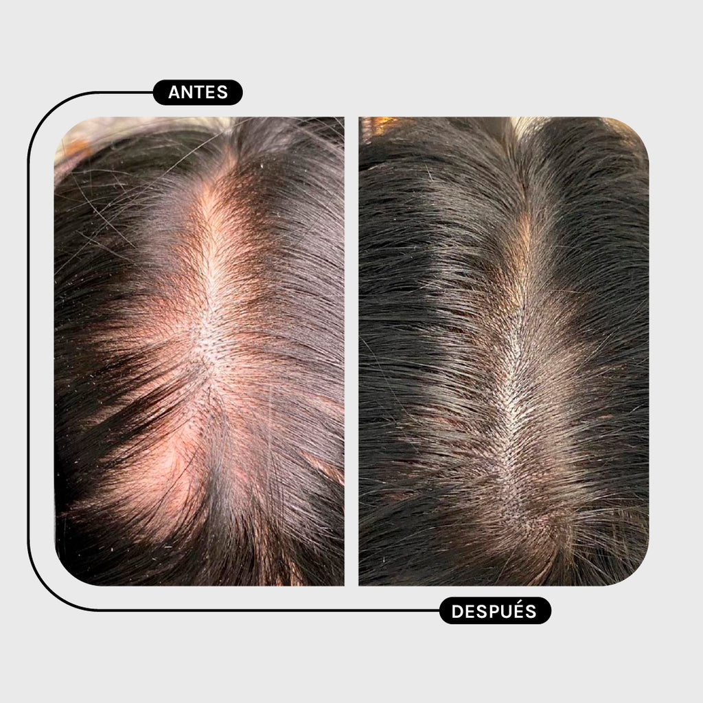 TRATAMIENTO CALÉNDULA