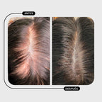 TRATAMIENTO CALÉNDULA