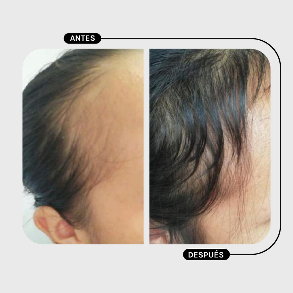 ACONDICIONADOR PILOSTRONG - CALÉNDULA