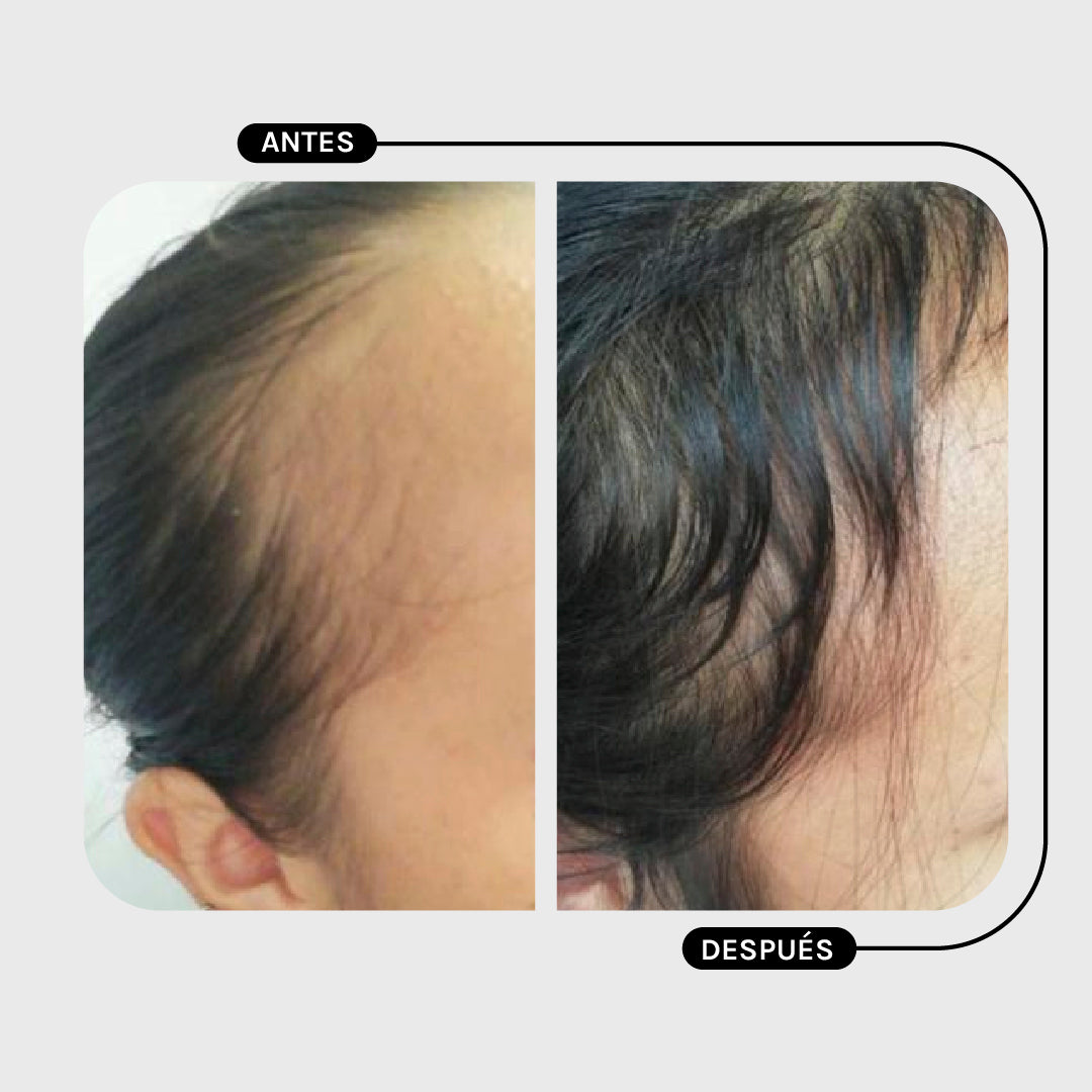 ACONDICIONADOR PILOSTRONG - CALÉNDULA